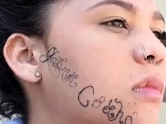 ‘Me sinto livre’, diz jovem ao iniciar remoção de tatuagem feita no rosto pelo ex-namorado