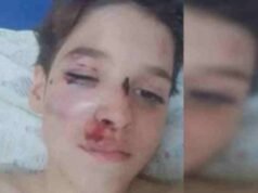 Situação desesperadora”, diz mãe de menino atingido por ônibus no DF