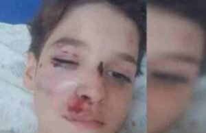 Situação desesperadora”, diz mãe de menino atingido por ônibus no DF