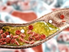 Anvisa aprova remédio para colesterol injetado apenas 2 vezes por ano