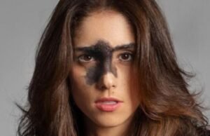 Influencer com pinta no rosto questiona padrões de beleza na internet